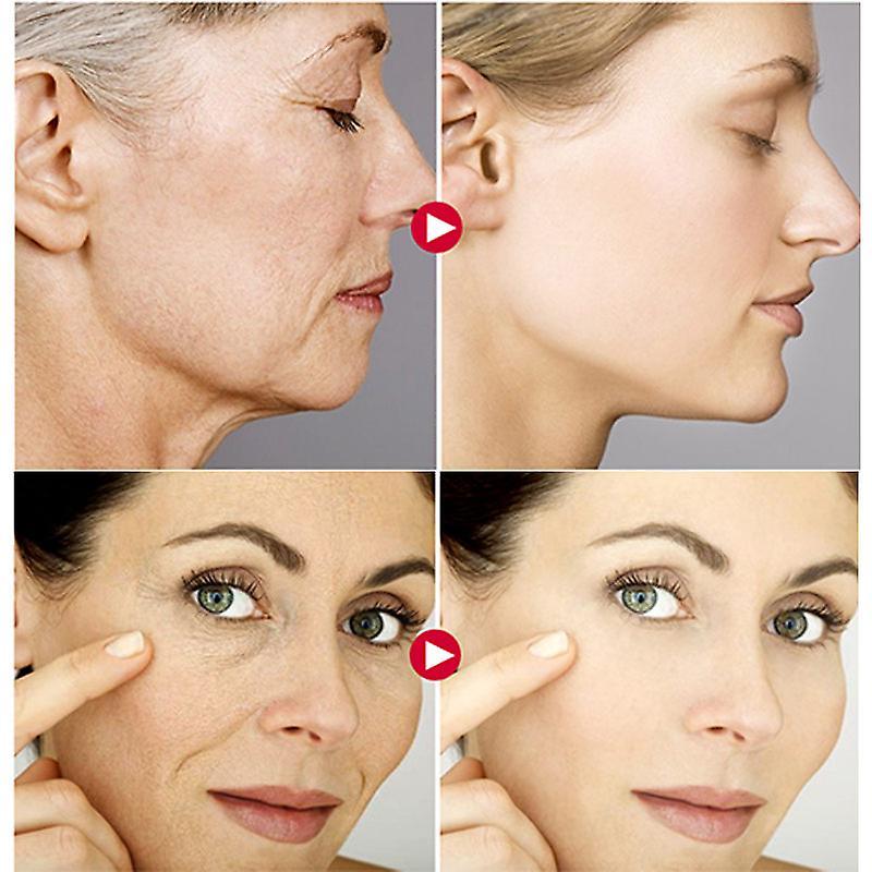 Rynkborttagare Ansiktsserum Lyftande Anti-aging Reducera Fina Linjer Återfuktande Essens