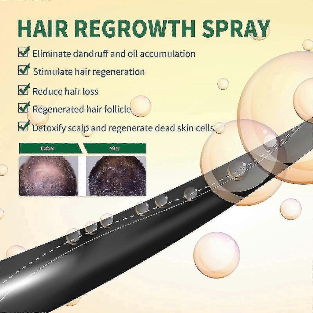 Ouhoe Haarausfall-Spray: Verdickender, Anti-Haarausfall, Reparatur von Haarfollikelschäden, Spray für trockenes und krauses Haar