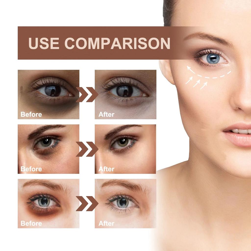 Dark Circles Removal Eye Serum Anti-wrinkle Dark Circles Puffiness Fades Fine Lines Moisturizing Firming Repair Eyes Skin Care