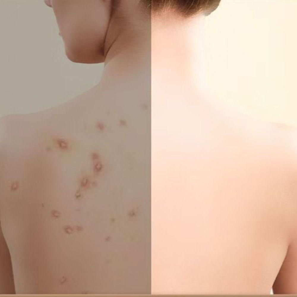 Duck Shaped Shower Foot Scrubber Mat with Suction Cups Massage Pad Foot Pedal  Washroom