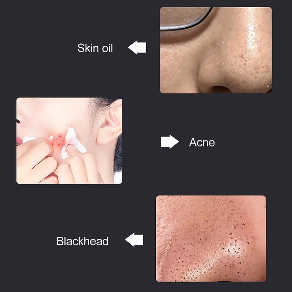 USB-Aufladung LED Photon Hautverjüngungsmaschine Akneentfernung Farblichttherapie Gesichtsmaske