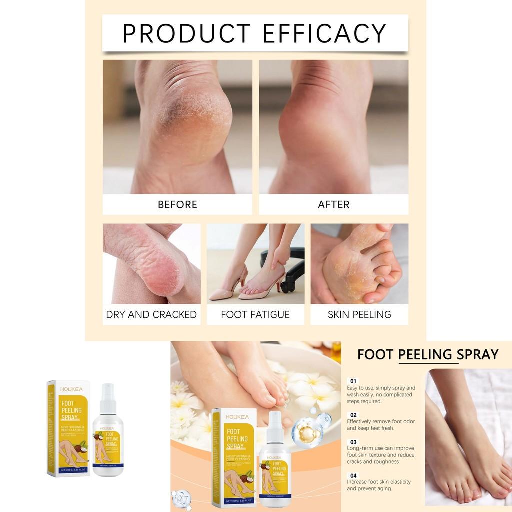 Houkea Exquisite Foot Exfoliating Spray For Gentle Cleansing And Softening Skin