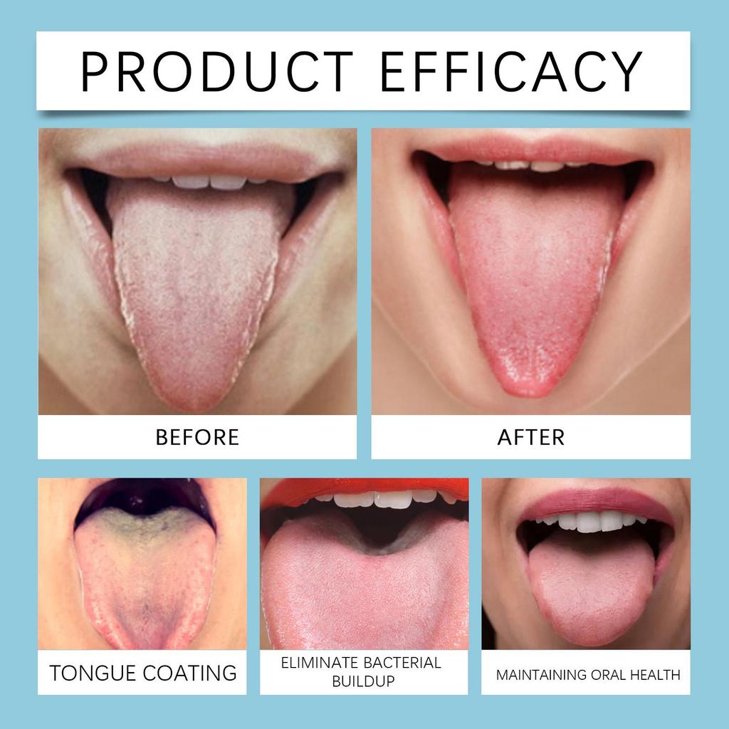 Tongue Cleaning Kit Easy Tongue Cleaning Hygiene Clean Odor Care Oral Care Kit
