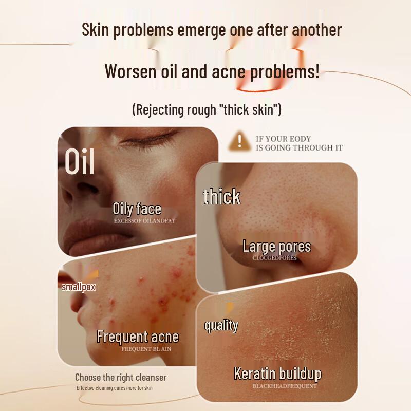 Renhe Jiangxin Sulfur Acne & Oil Control Facial Cleanser