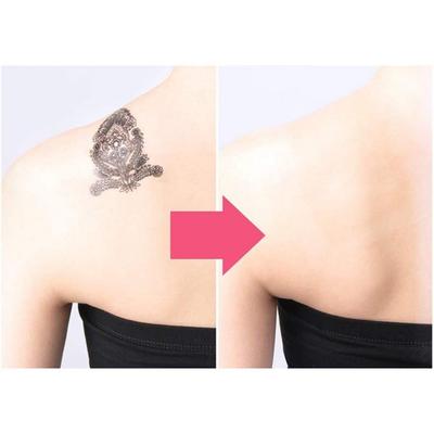 Adesivo para cobrir cicatriz de tatuagem, 3 peças, grande, natural