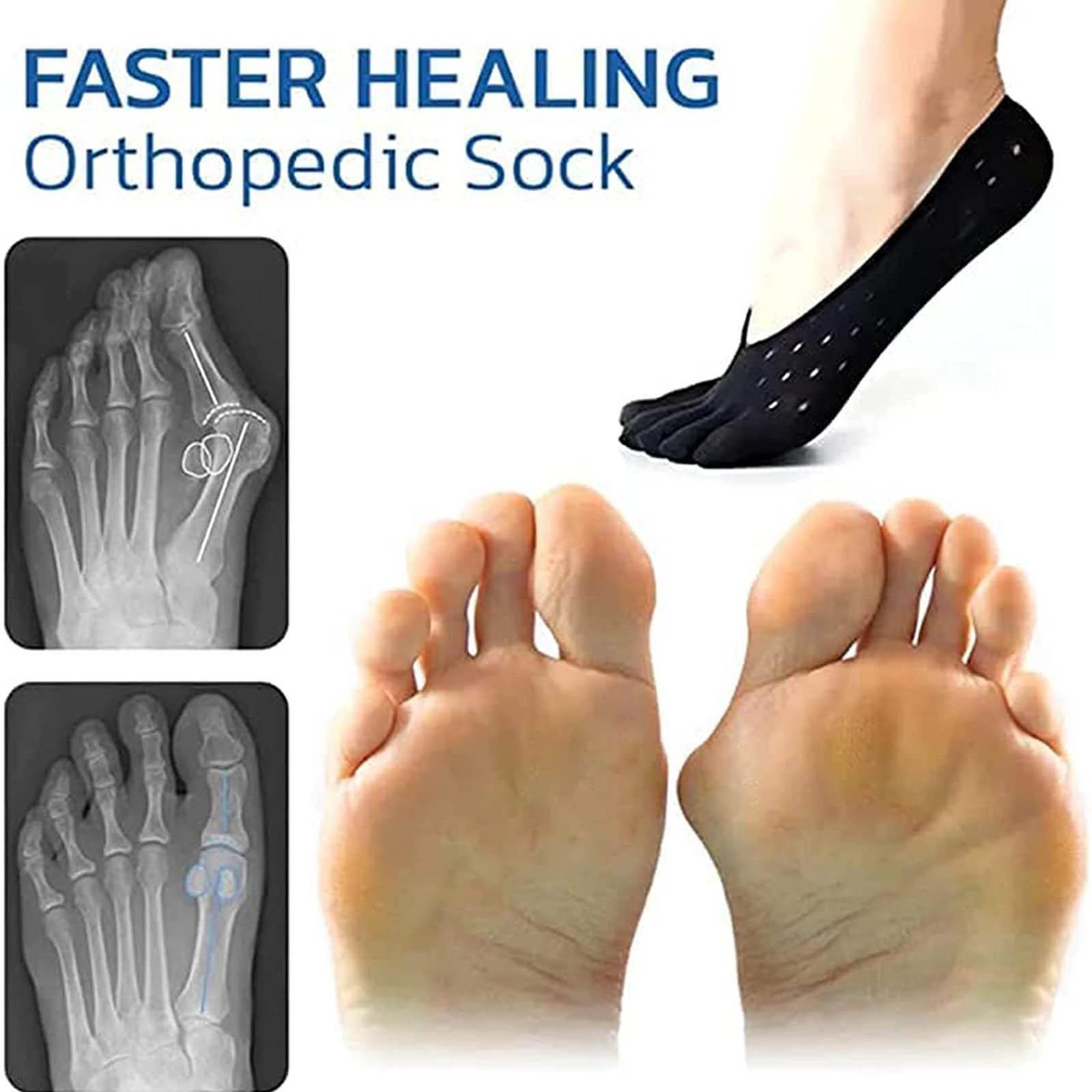 

5шт Ортезы Bunion Рельеф Носки Volikon Bunion Носки Projoint Antibunions Здоровье Носки