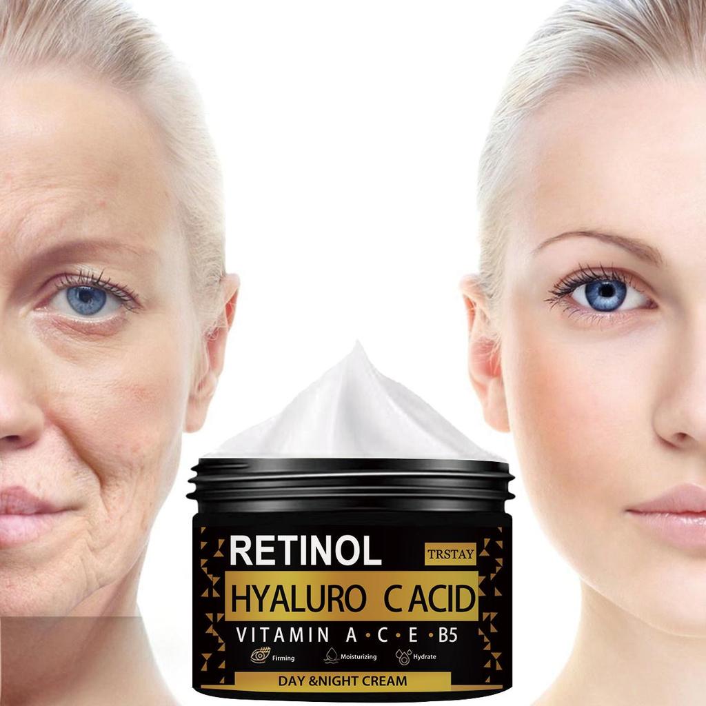 TRSTAY Ser antirid, anti-îmbătrânire, fermitate Acid hialuronic, vitamina A, cremă de față cu retinol, poate reduce ridurile și petele negre la femei
