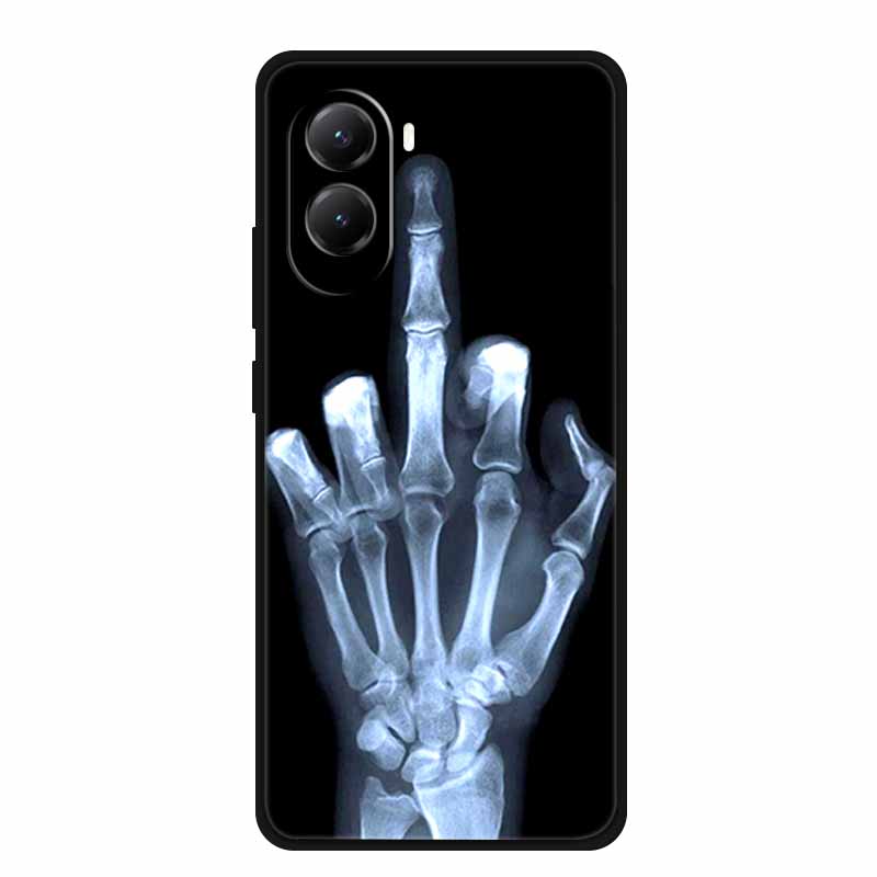

Для Xiaomi Poco M7 4G Чехол Животные Мягкий Силикон ТПУ Чехлы для Телефона Задняя Крышка для PocoM7 4G Лев Ударопрочный Защитный Волк Capa Poco M7 4G