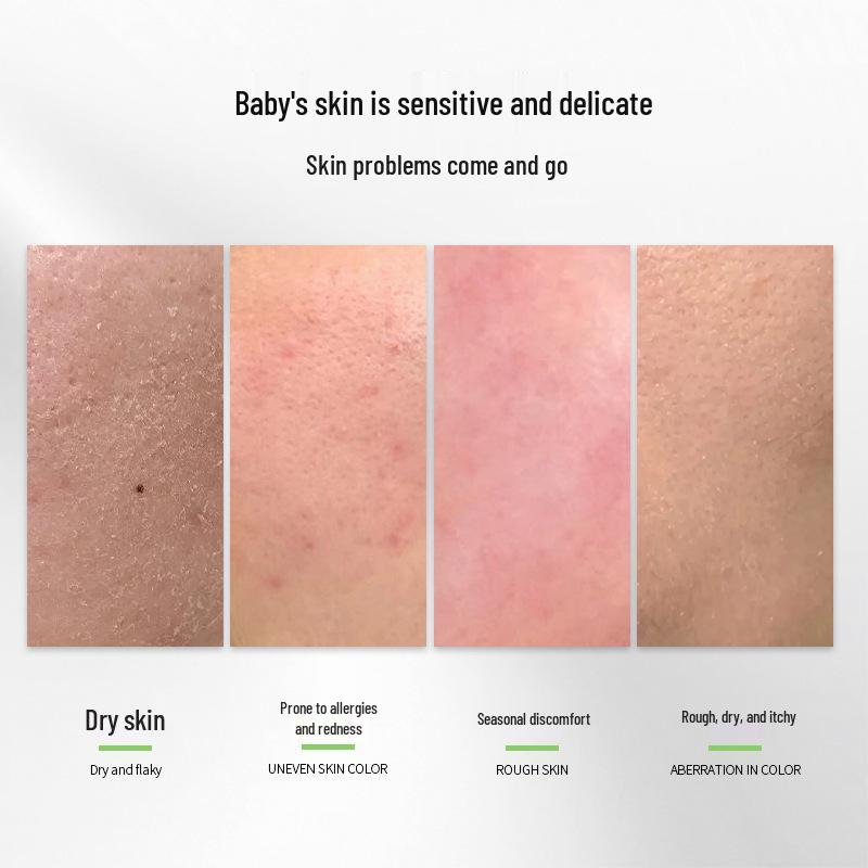 YABI Gentle Lanolin Body Lotion for Kids: Hydrating and Skin-Friendly Moisturizer for Autumn and Winter.