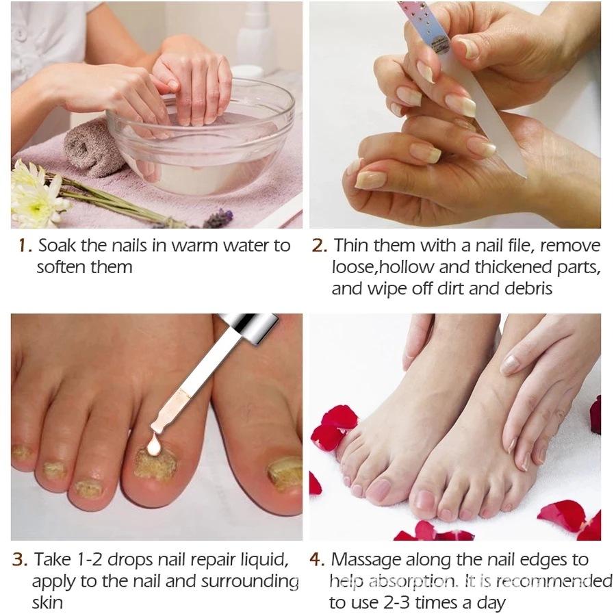 SUAI Nail Fungus Repair Liquid - Toenail Fungus Treatment, Antifungal Solution for Nail Bed, Cuticle Care, Portable Clear Liquid 30ml