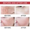 Hoygi Dark Spot Repair Essence: Lightens Dark Spots, Reduces Pigmentation, Age Spots, Moisturizes and Brightens Skin.