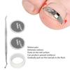 2pcs Ingrown Toenail Corrector Stainless Steel Straightening Pedicure Tool for Paronychia Treatment
