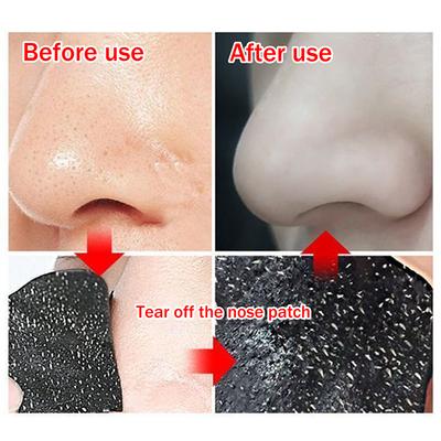 5/15/25/50 Pcs Bamboo Charcoal Blackhead Removal Nose Pore Strips Deep Cleaning Pore Clean Acne Nose Care Mask Patch Smooth Skin