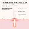 Pimple Patches For Face,Zit Covers,Hydrocolloid Acne Patches Zits Cover Stickers 2 Size 36pc