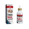 Graue Nagelreparaturflüssigkeit - Stärkt, Heilt & Bekämpft Pilzinfektionen - 50ml