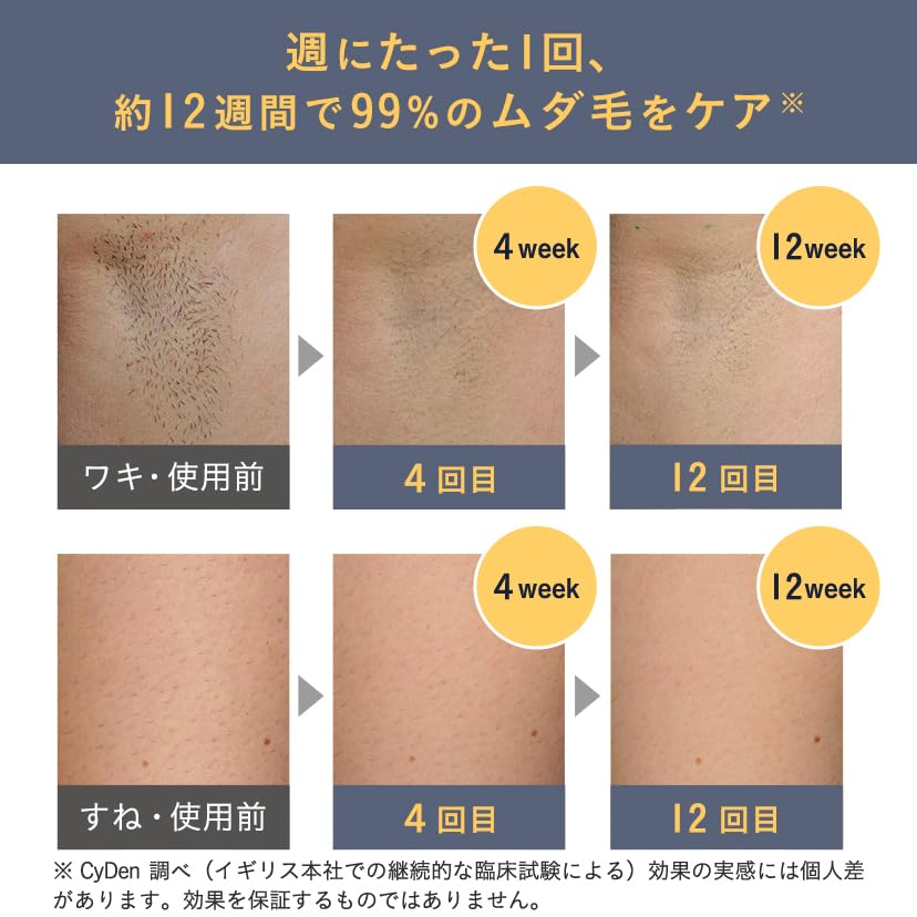 Smoothskin Pure Unplugged Cordless Hair Removal Device for Perfect for and Full Body Pinpoint Bead 1 Million Included Continuous IPL No Cooling Men's