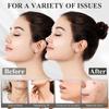 Cinghia per il mento per dormire, Cinghia per il mento regolabile, Cinghia per la mascella, Modellante per la mascella, Maschera lifting V-line, Nero