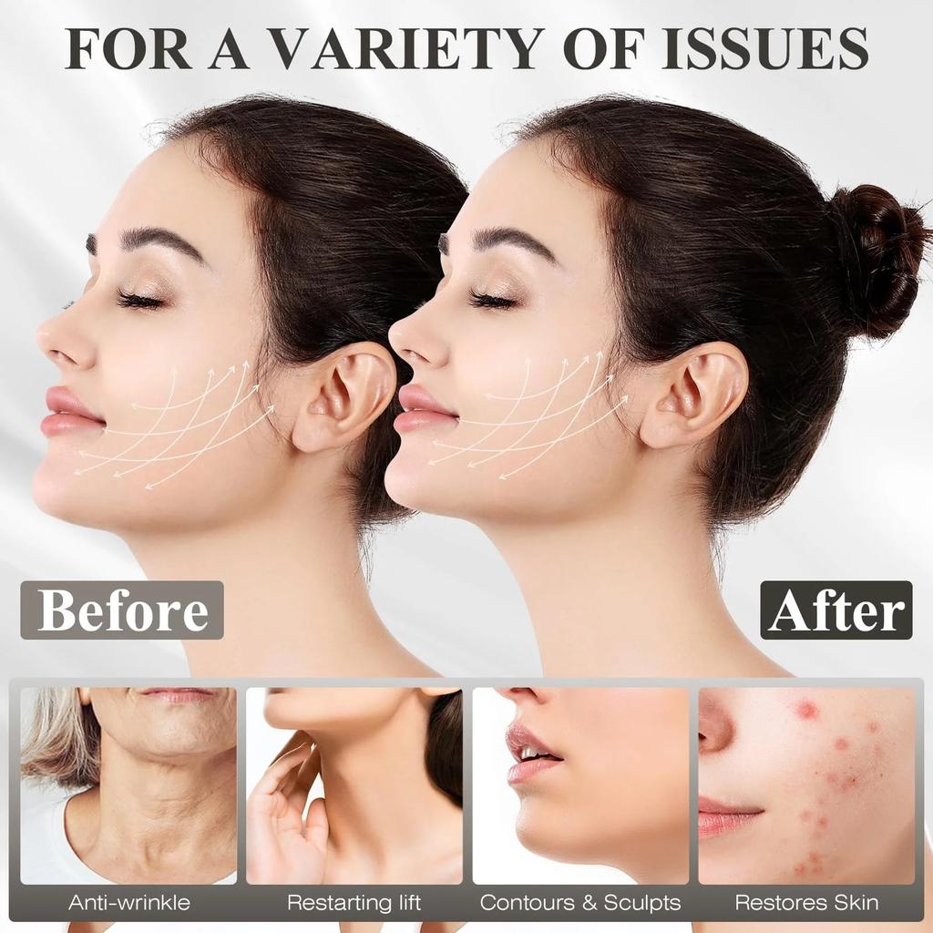 Cinghia per il mento per dormire, Cinghia per il mento regolabile, Cinghia per la mascella, Modellante per la mascella, Maschera lifting V-line, Nero