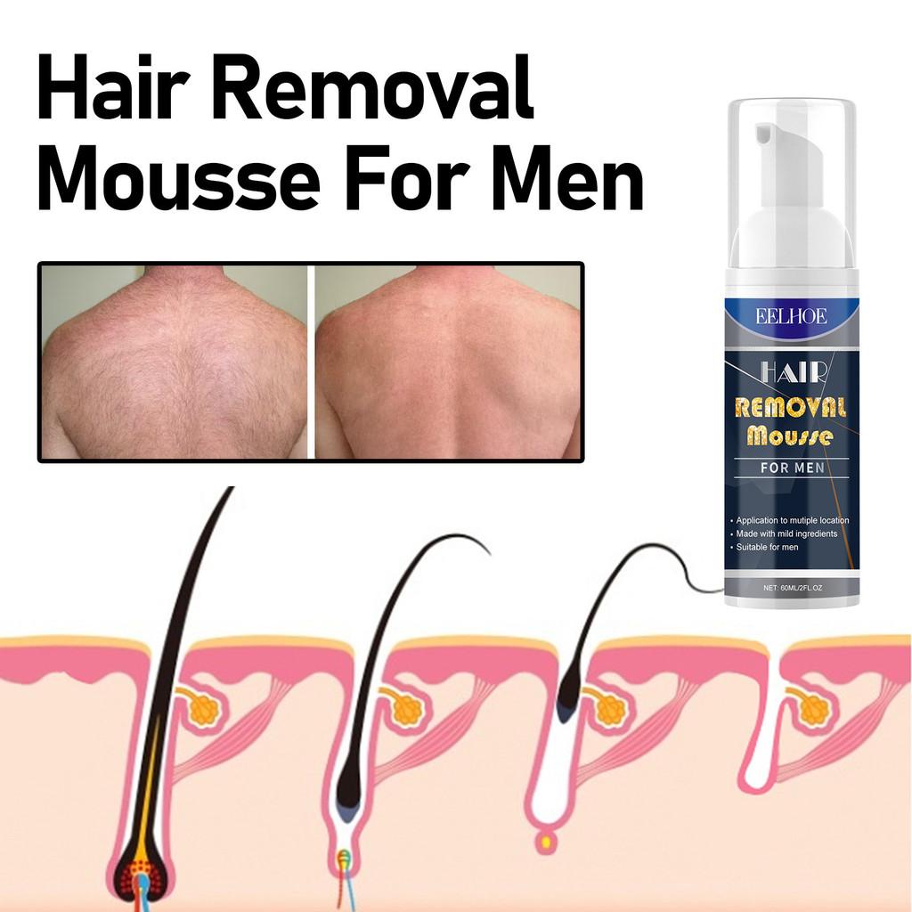 Eelhoe Men's Hair Removal Mousse Gentle And Soothing Formula For Body And Chest