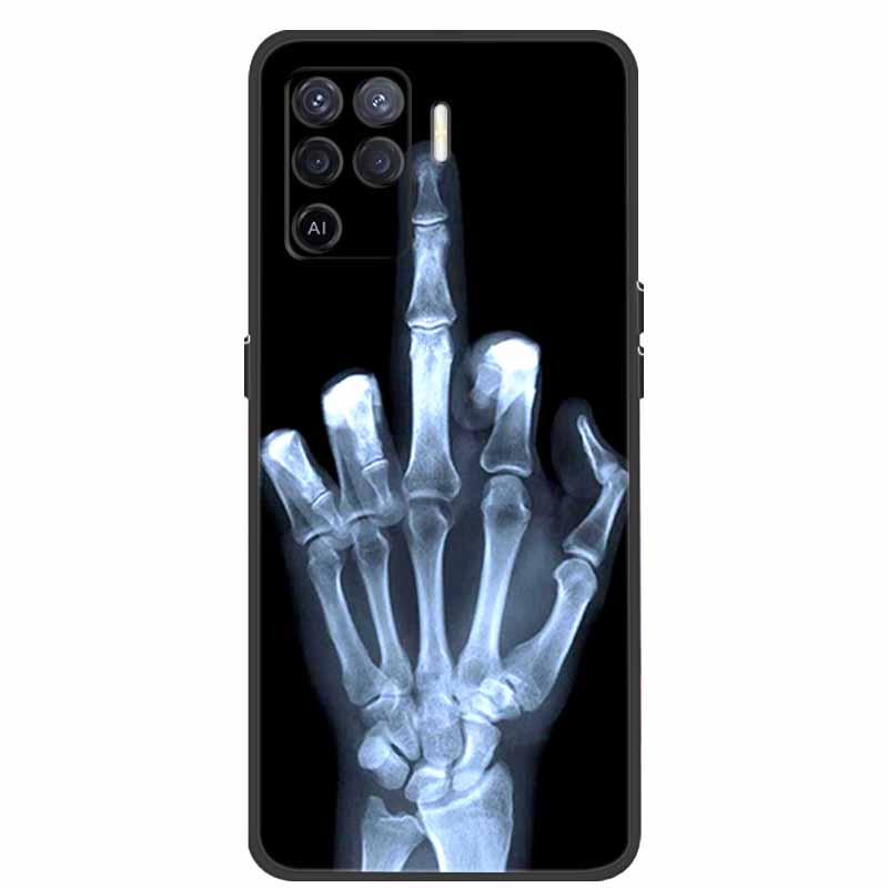 For Coque OPPO Reno5 Lite Case Shockproof Soft silicone TPU Back Cover For Oppo Reno 5Z 5 Lite Phone Case 5Lite CPH2205 Fundas