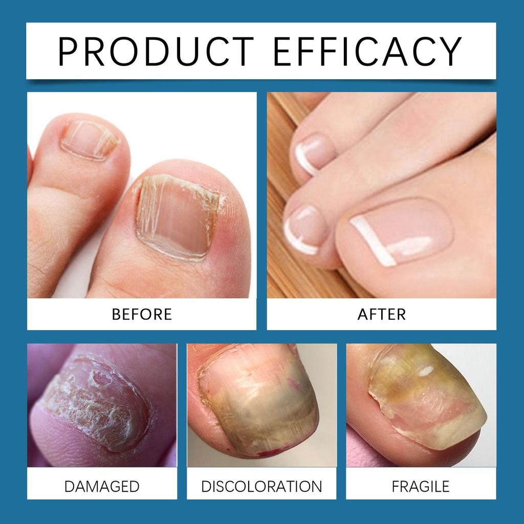 South Moon Nail Care Spray Gentle Care For Hands And Feet Nails Daily Moisturizing And Cleansing 20ml