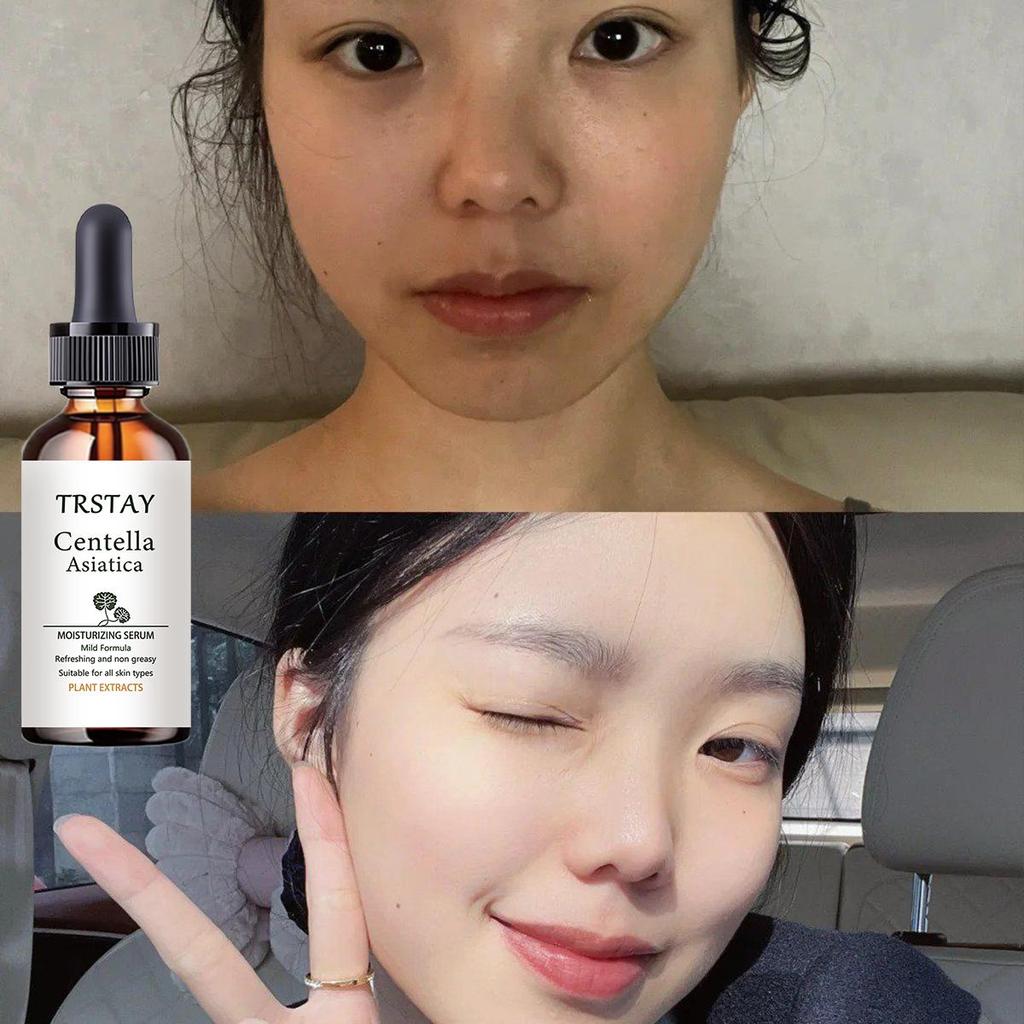 Vitamin C facial essence can moisturize, moisturize and improve damaged skin