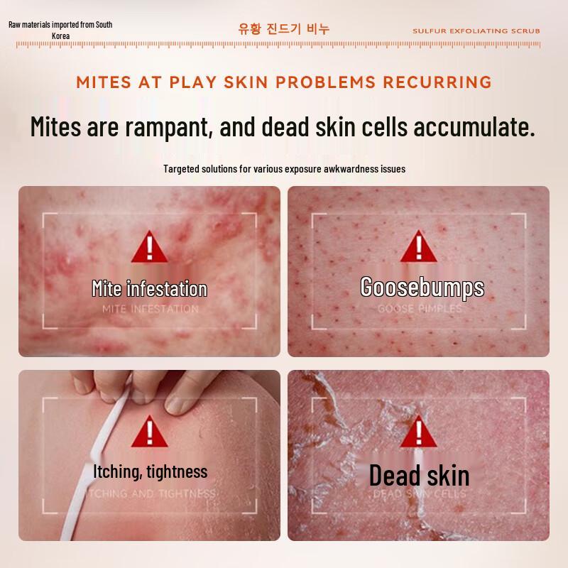 SEEDONVEUR Sulfur Mite Removal Scrub Shower Gel