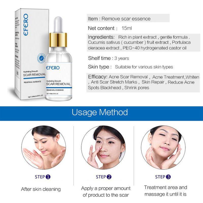 Buy Scar Removal Liquid Acne Mark Stretch Marks Scar Repair Liquid at