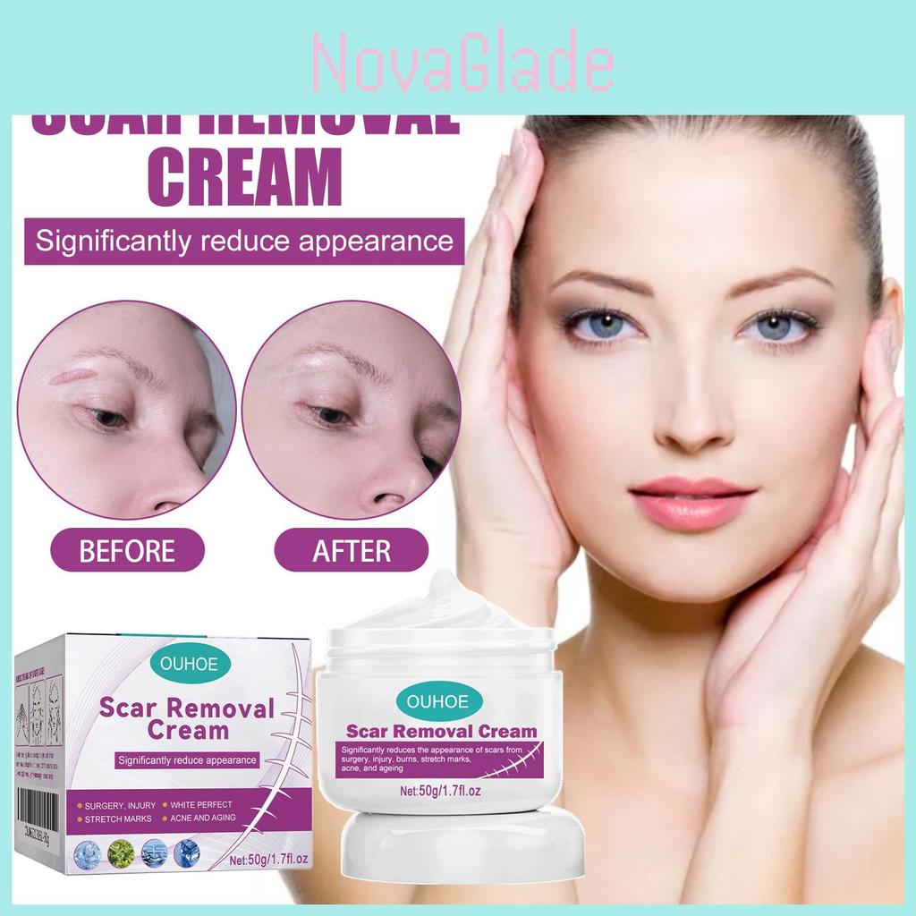 Ouhoe Scar Care Cream For Smoothing And Moisturizing Skin With Gentle Formula