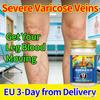 Feel Lighter In Just Days – Herbal Cream for Better Leg Comfort, Promotes Circulation, EU 3-Day Delivery