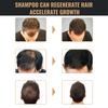 5 st Spartan Root Activator Schampo, Spartan Håravfallsschampo,schampo Root Activator