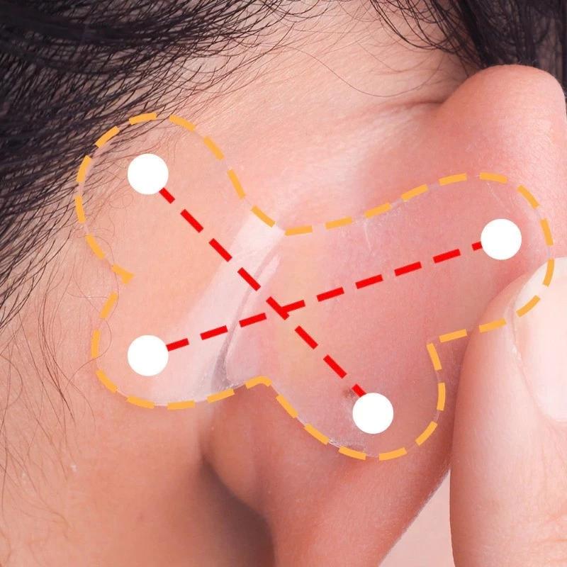 Elf Ear Stickers Butterfly-Shaped Reusable Invisible Ear Lobe Correction Patch Silicone Waterproof Tape for Ear Support Patch
