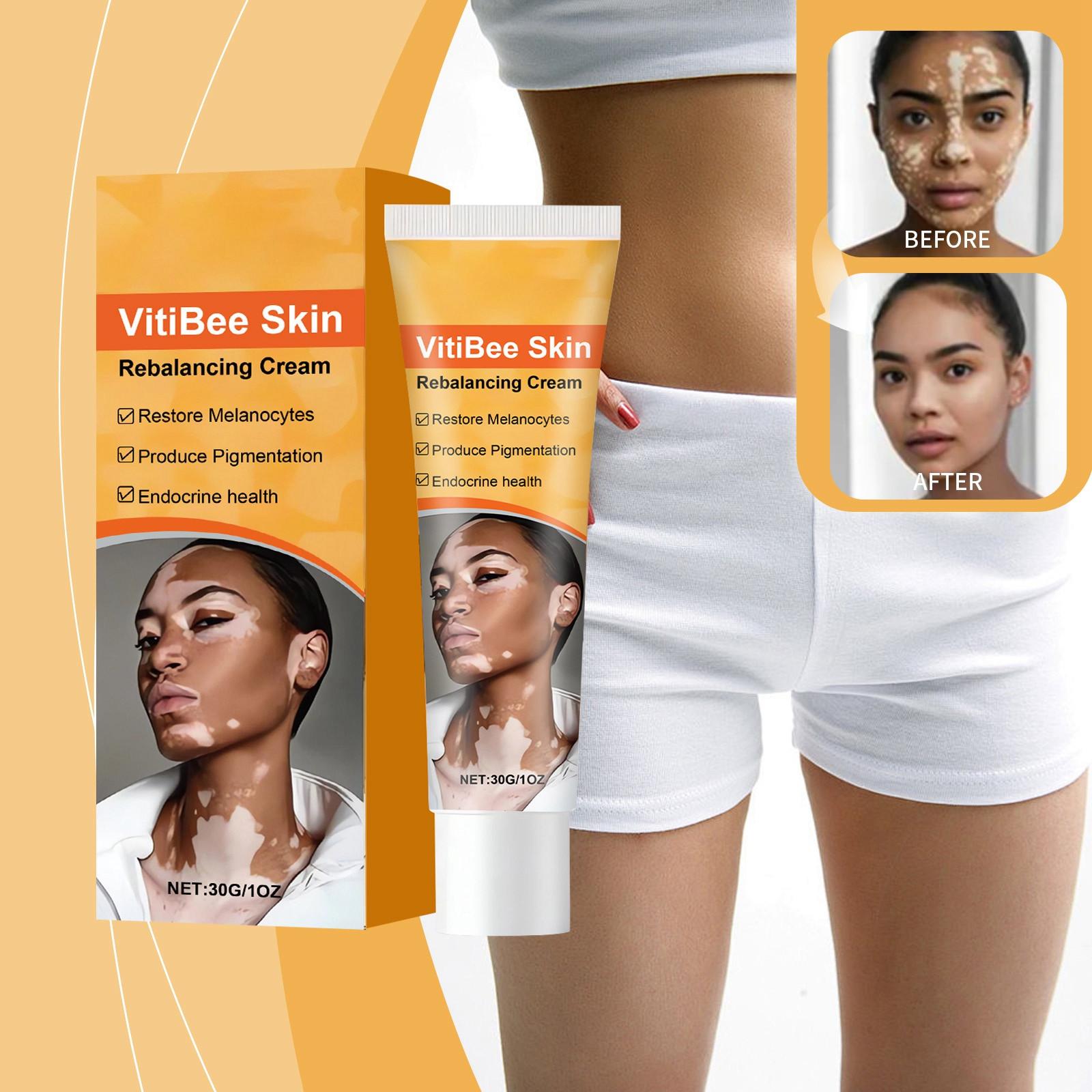 

Крем для баланса кожи , Пигментация кожи , Витилиго , Уход за желтовато-коричневой кожей , Воспаление , Мягкая и увлажняющая текстура , Легкий и легко впитывающийся. One Size оранжевый