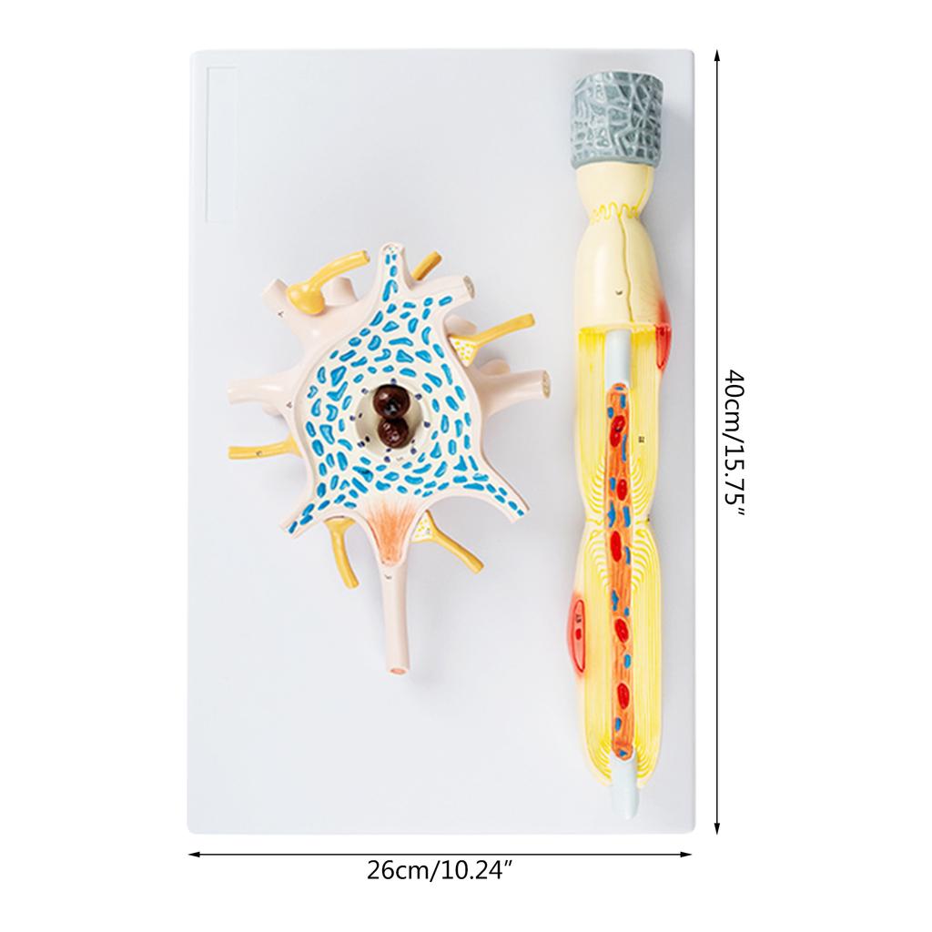 Neuron Amplification Model, Human Anatomy Model, Neuronal Cell Body and Nerve Fiber Structure Amplification Model Teach