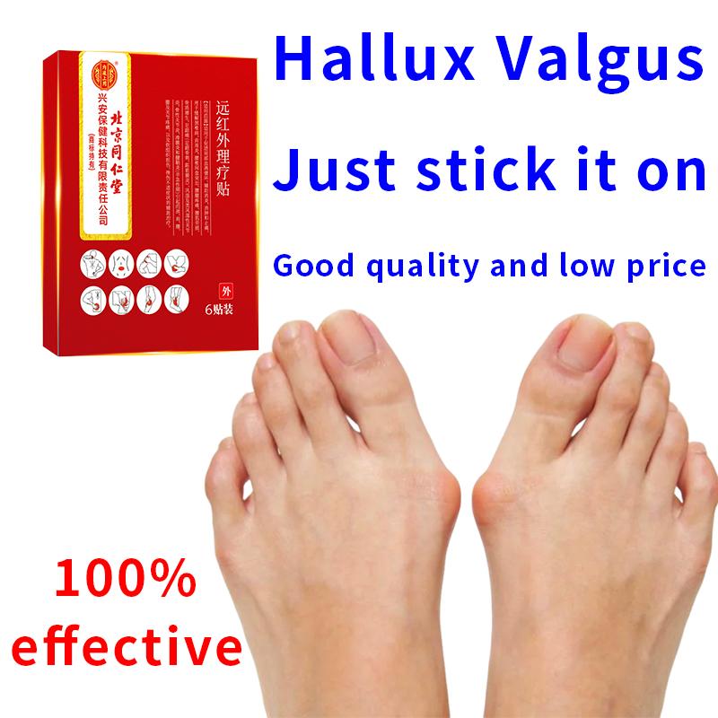 

Пластырь для коррекции бурсита бурсита, успокаивающий отек ног, пластырь для ухода за травами