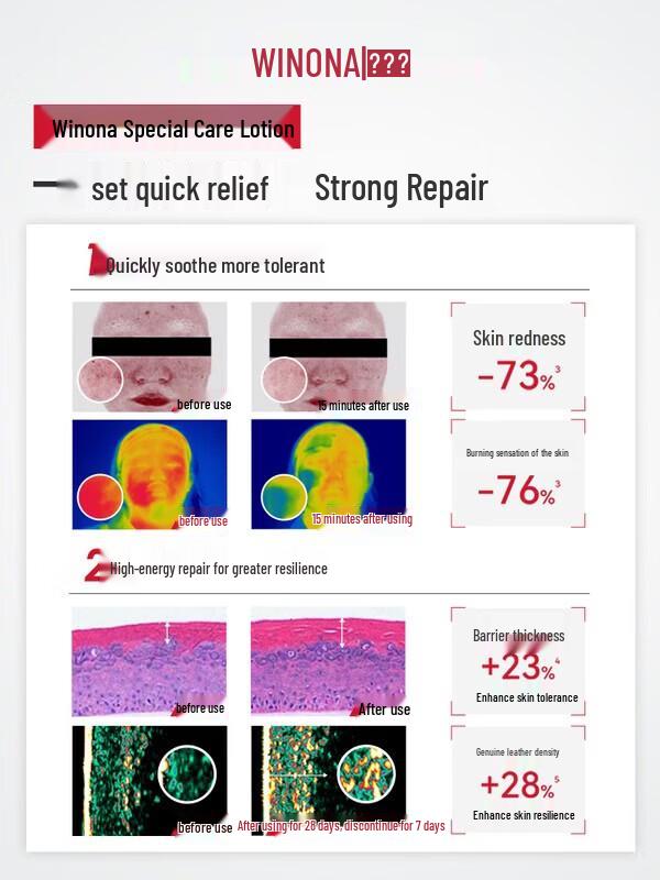 Winona Special Care Feuchtigkeitspflege Set