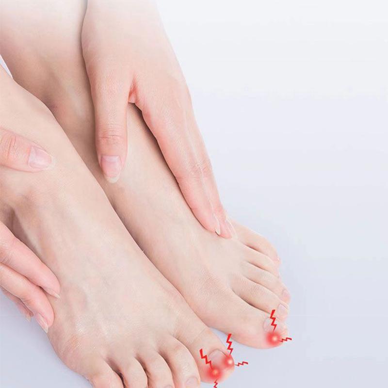 Werkzeuge zur Korrektur eingewachsener Zehennägel, Pediküre, Wiederherstellung, eingebettete Zehennagelbehandlung, professionelles Fußpflegetool zur Korrektur eingewachsener Zehennägel