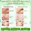 Kiss Beauty Aloe Vera Gel Gel Feuchtigkeitsspendende Essenz Gel Feuchtigkeitsspendende Feuchtigkeitscreme Aloe Vera Gel