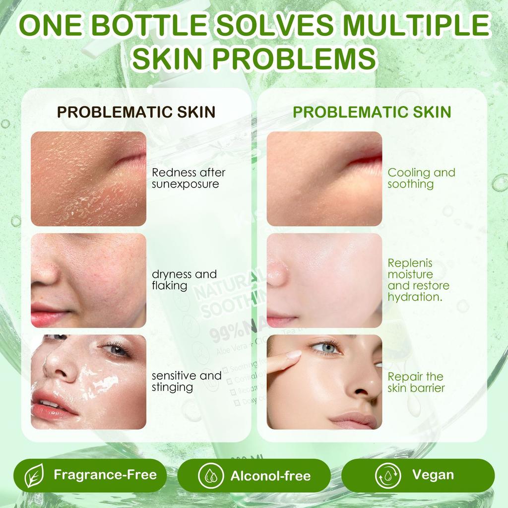 Kiss Beauty Aloe Vera Gel Gel Feuchtigkeitsspendende Essenz Gel Feuchtigkeitsspendende Feuchtigkeitscreme Aloe Vera Gel