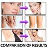 Hoygi Black Spot Skin Repair Cream For Diminishing Fine Lines And Dark Spots