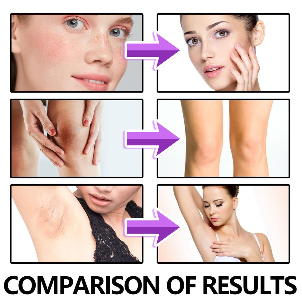 Hoygi Black Spot Skin Repair Cream For Diminishing Fine Lines And Dark Spots