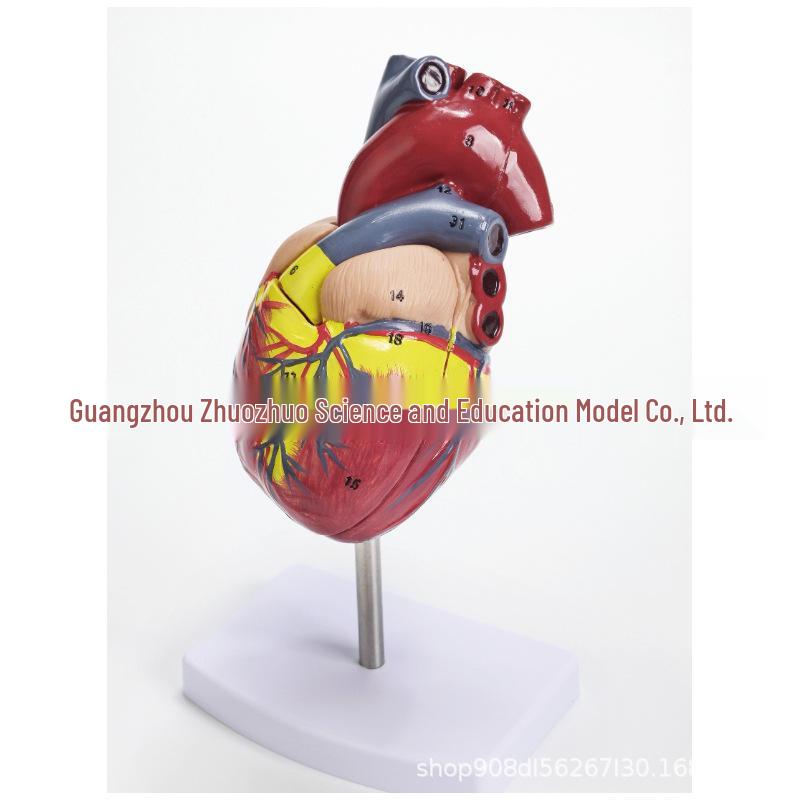 1:1 Human Heart Anatomy Model with 34 Markings, Large Color Doppler B-Ultrasound Mold for Teaching