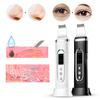 2026 New Trending Ultrasonic Ion Therapy Face Skin Scrubber Facial Cleaner Warm Heating Spatula Peeling Vibration Skin Scrubber