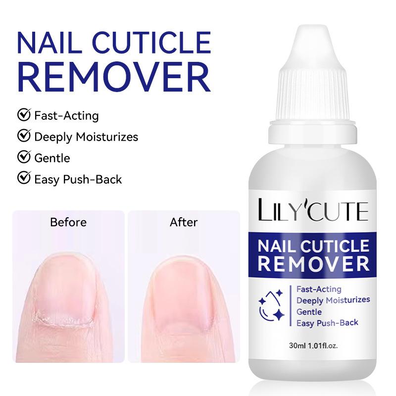 30ml Nail Cuticle Remover Gel Professional for Dead Skin Care Fast Softening Gel for Manicure Home Salon