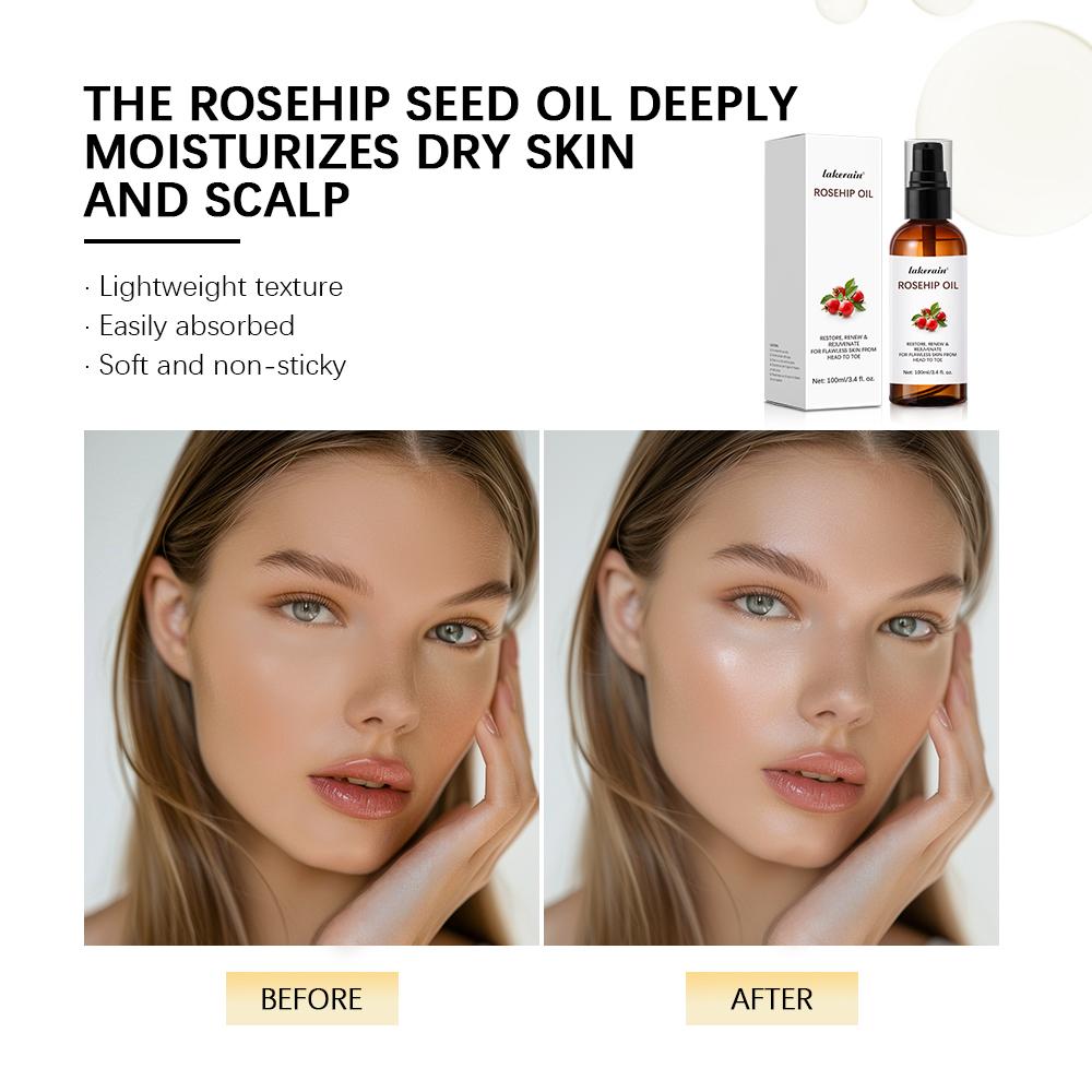 Organic Rosehip Oil Rose Hips Face Oils 30ml Fast-Absorbing Skin Care Moisturizer Face Oil Organic Rosehip Seed Oil Essence
