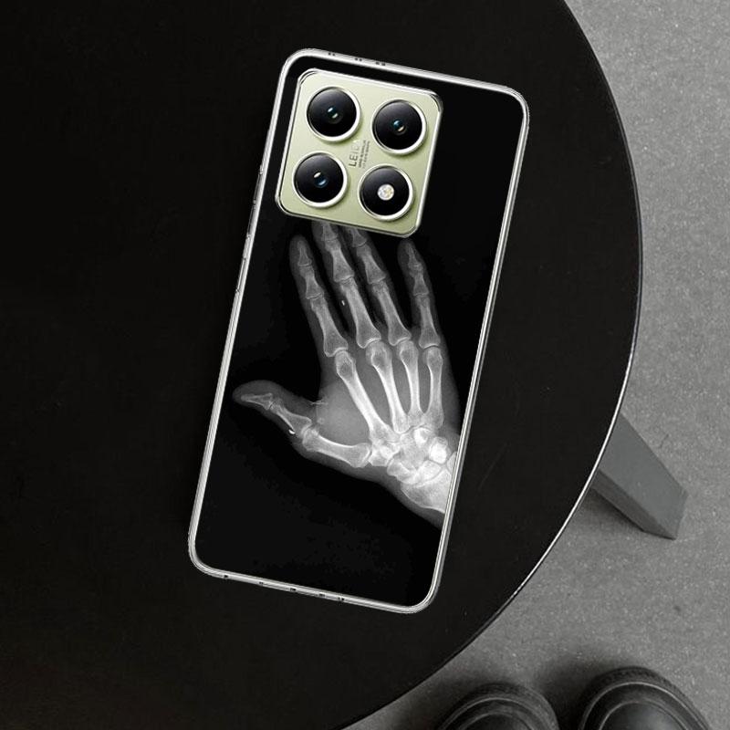 Autumu X Ray Hand Bones Phone Case Cover for Xiaomi Redmi Note 15 14 13 12 11 Pro Plus 14S 12S 11S 11T 11E 10S 10 Customized Fun
