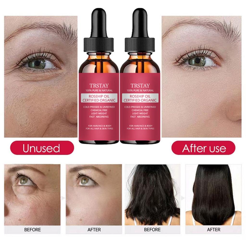 5% Minoxidil Biotin Hair Serum For Men And Women Dense Hair Serum Healthy Hair Penetrates Root To Tip