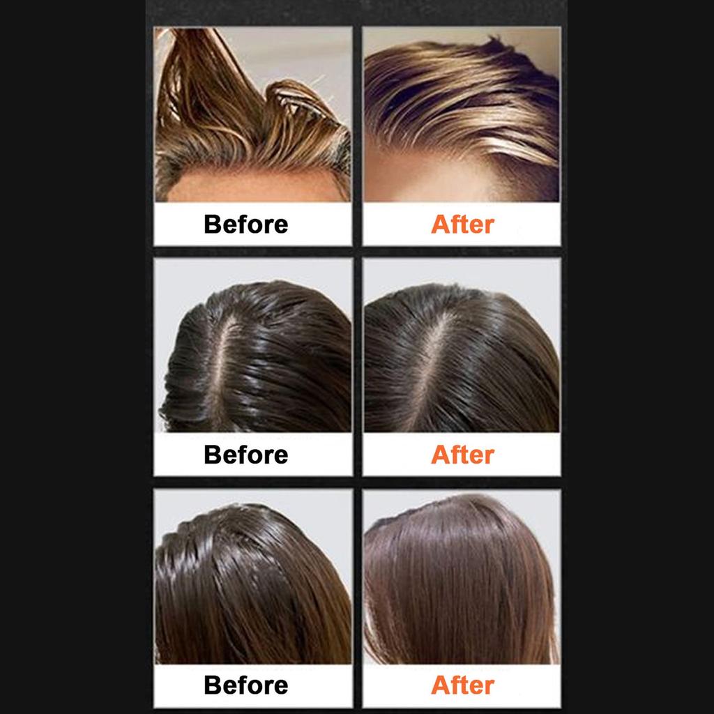 Fixierpuder, Trockenshampoo-Puder und No-Rinse-Haarpuder sind für die meisten Haartypen geeignet, 30g