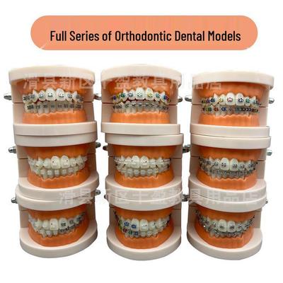 Orthodontic Dental Model: Metal Ceramic Self-ligating for Doctor-Patient Communication and Teaching