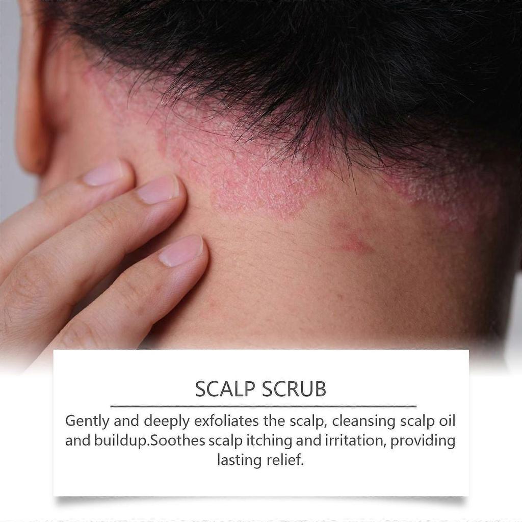 Hoegoa Scalp Scrub Shampoo, Nourishing And Moisturizing Hair, Smooth Dry Hair, And Cleansing Shampoo